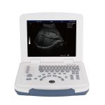 dw-580-ultrasound machine