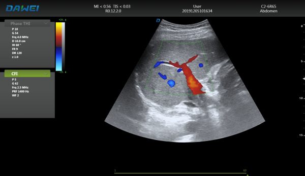 DW-T8 ultrasound machine image abdomen