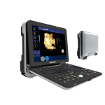 dw-p6 ultrasound machine