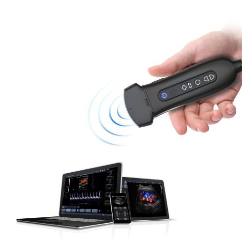 Échographe sans fil Youkey Q7 – appareil à ultrasons mobile